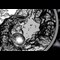 2024 Yin And Yang Silver 1Oz Lifestyle 04